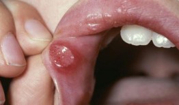 吃瓜嘴角流血图片搞笑,笑到肚子疼的搞笑瞬间